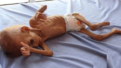 Photo of یمن میں ہر پانچ منٹ میں ایک بچے کی موت